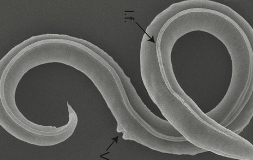 Screenshot 2023-07-28 at 19-48-01 Ученым удалось оживить червей которым 46 тысяч лет.png